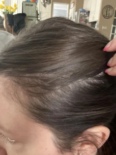 Біотин для росту волосся: швидке відновлення для чоловіків та жінок photo review