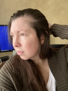 Біотин для росту волосся: швидке відновлення для чоловіків та жінок photo review