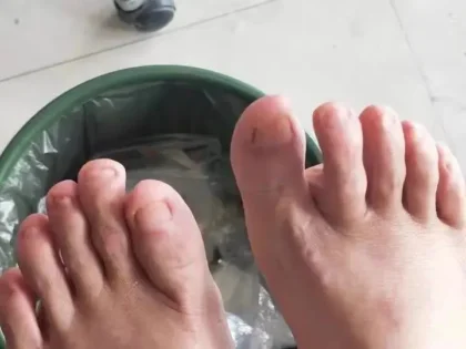 Fungal Nail Repair - Швидке лікування грибка нігтів photo review