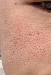 Центелла Тон Брайтенінг Капсула: Сияюча шкіра з перших днів! photo review