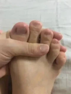 Лікування грибка нігтів: Серум для видалення грибка на нігтях photo review