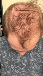 Масло розмарину для росту волосся - PURC для чоловіків та жінок photo review