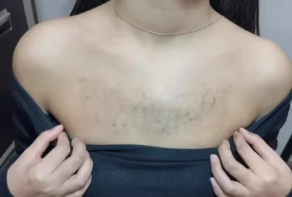 Видалення тату: гель для глибокого видалення упертих тату photo review