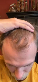 Масло розмарину для росту волосся - PURC для чоловіків та жінок photo review