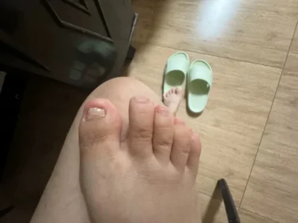 Fungal Nail Repair - Швидке лікування грибка нігтів photo review