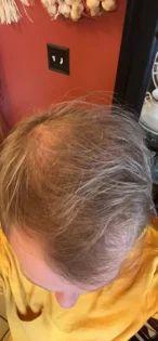 Масло розмарину для росту волосся - PURC для чоловіків та жінок photo review