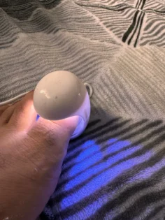 Fungal Nail Repair - Швидке лікування грибка нігтів photo review