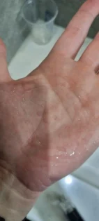 Скалп апплікатор для рідин - ефективний масажер для волосся photo review