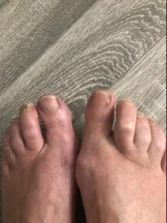 Лікування грибка нігтів: Серум для видалення грибка на нігтях photo review