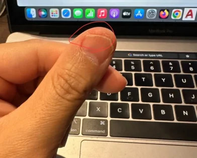 Лікування грибка нігтів: Серум для видалення грибка на нігтях photo review