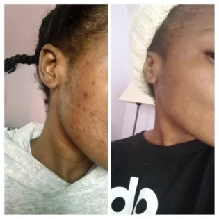 Вітамінізоване освітлююче молочко для тіла AILKE – Ваш секрет світливої шкіри photo review