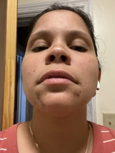 Вітамінізоване освітлююче молочко для тіла AILKE – Ваш секрет світливої шкіри photo review