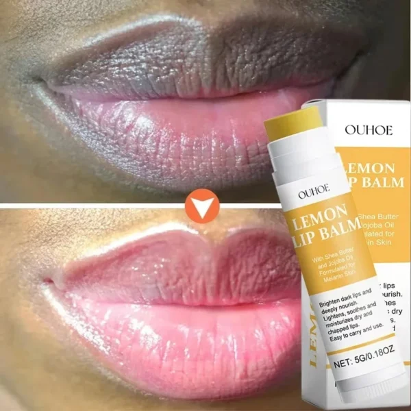 Видаляємо темні губи: Бальзам для губ, який освітлює меланін